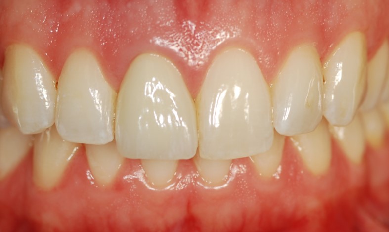 patient smile makeover prosthodontist Bethesda MD
