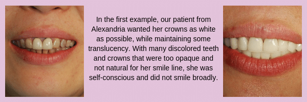 dental crown patient & story