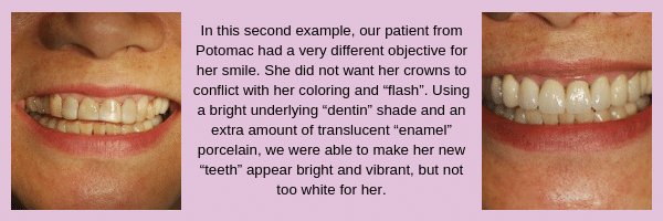 Dental-Crown-Patient-2