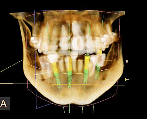 dental radiograph diagram