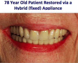 78 year old patient restored via hybrid appliance