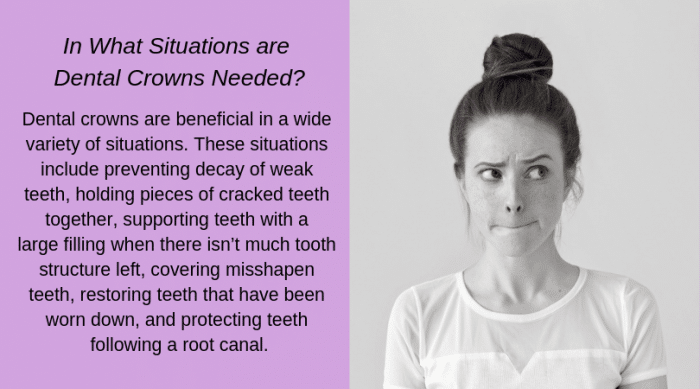 When Are Dental Crowns Useful