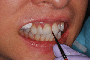patient having teeth exhamined