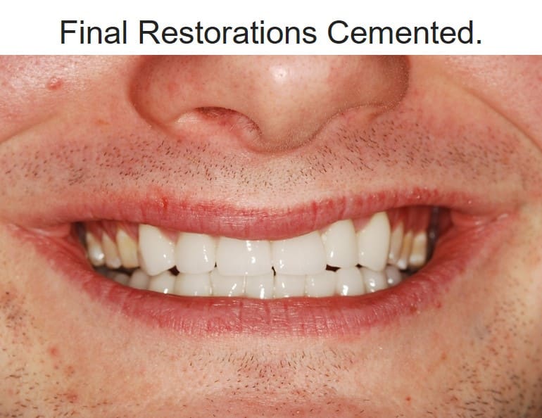 dental restorations prosthodontist Washington DC