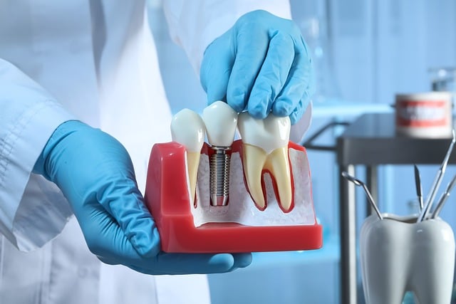 dental implant surgery Prosthodontics Bethesda MD