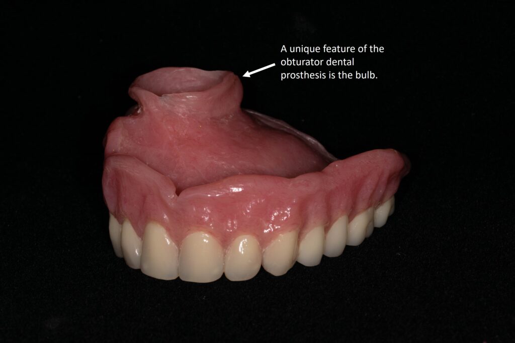 palatal obturator prosthodontics Bethesda MD